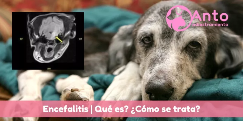 Encefalitis | qué es? y cómo la abordamos?